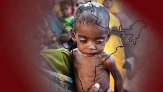33 lakh children are malnourished